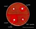 the optochin test with pneumococcus